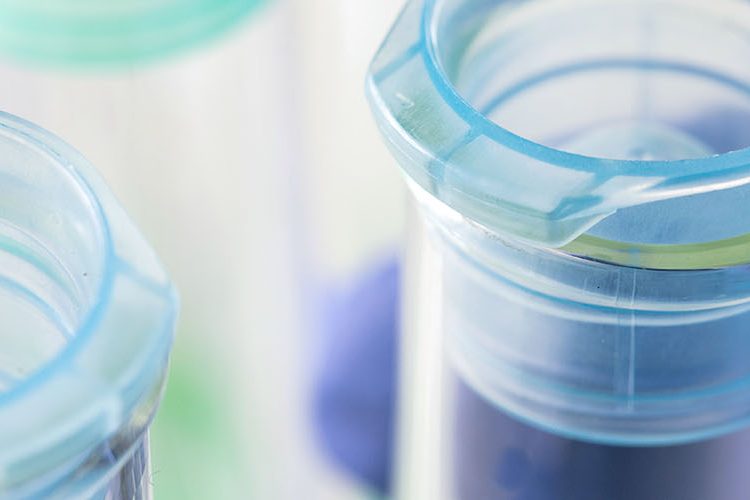 A close up of someone with a medical grade purple glove handling glass test tubes in fluorescent lab lighting