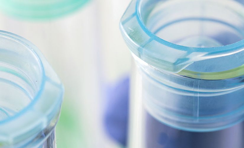 A close up of someone with a medical grade purple glove handling glass test tubes in fluorescent lab lighting