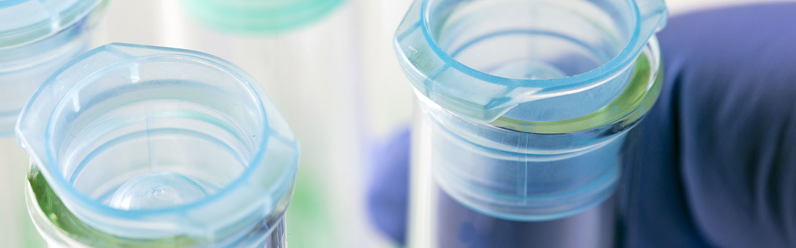 A close up of someone with a medical grade purple glove handling glass test tubes in fluorescent lab lighting